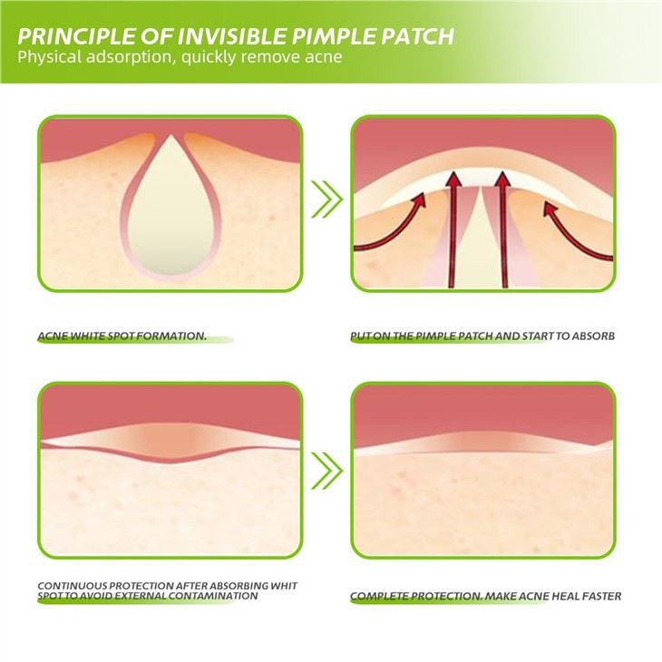 Cute Pimple Patches