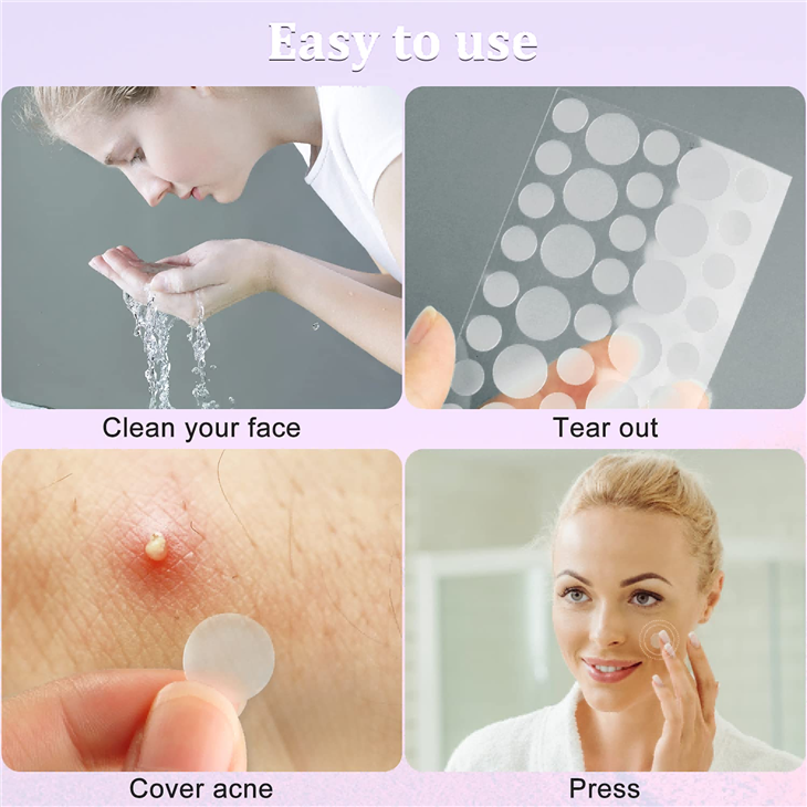 acne spot patches