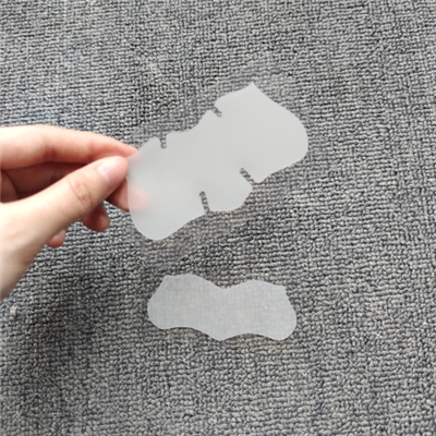 Rimozione dei punti neri delle strisce del naso